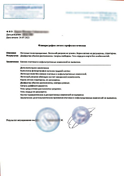 Купить справку о флюорографии в Москве.